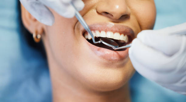 Best Emergency Broken Tooth Repair in Indio, CA